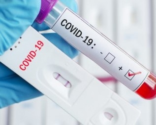 След направени 3722 теста за COVID 19 през последното денонощие у